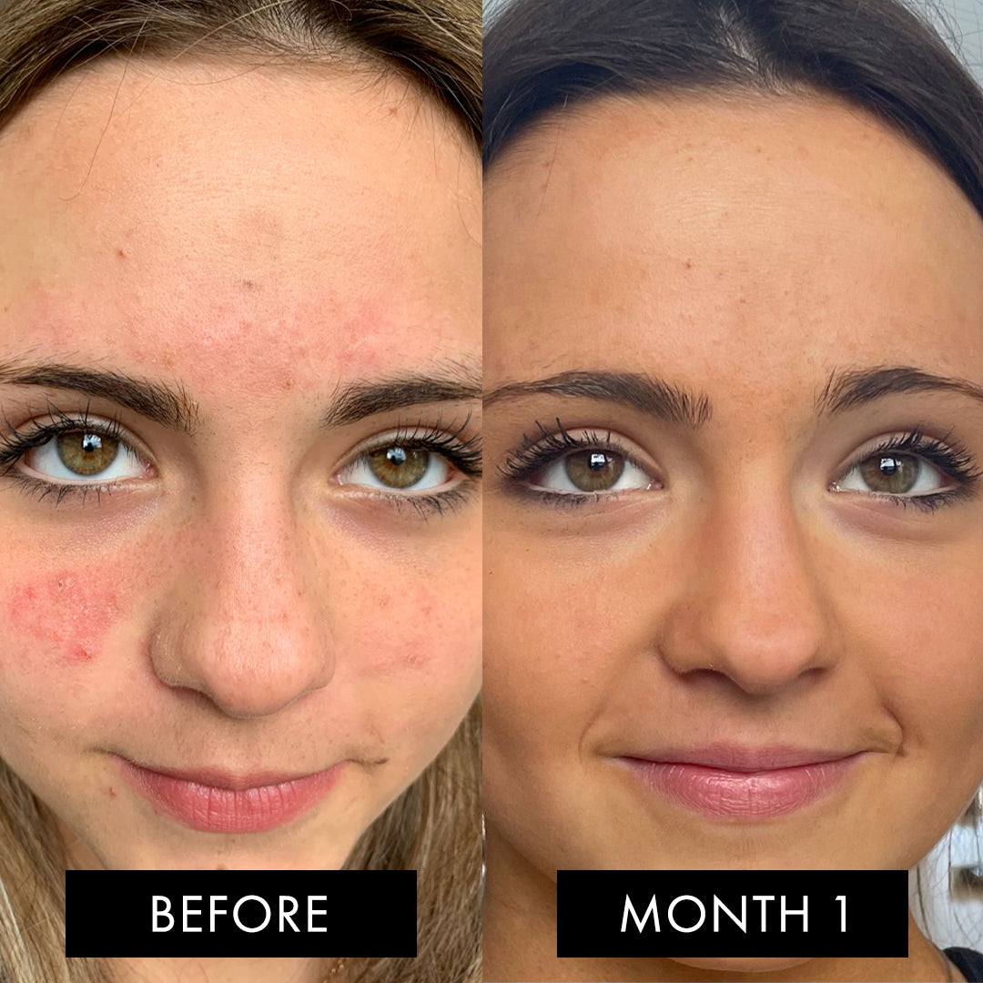 The Skin Elixir