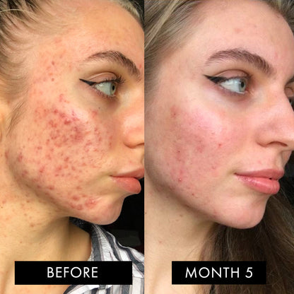 The Skin Elixir